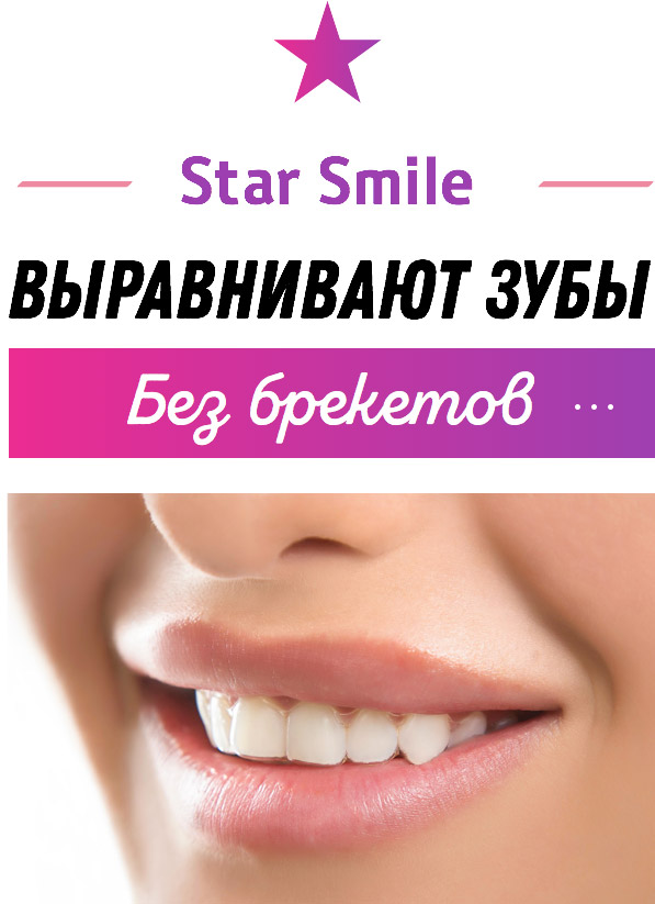 StarSmile выравнивает зубы без брекетов