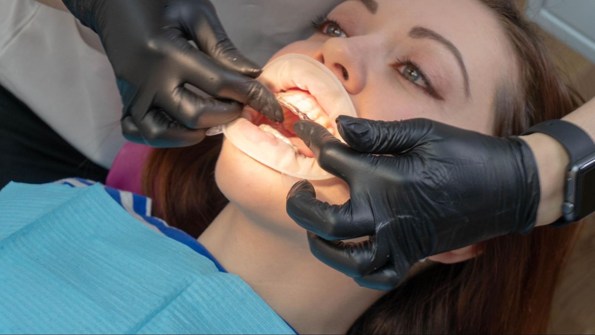 Как пациенту оценить результат ортодонтического лечения?