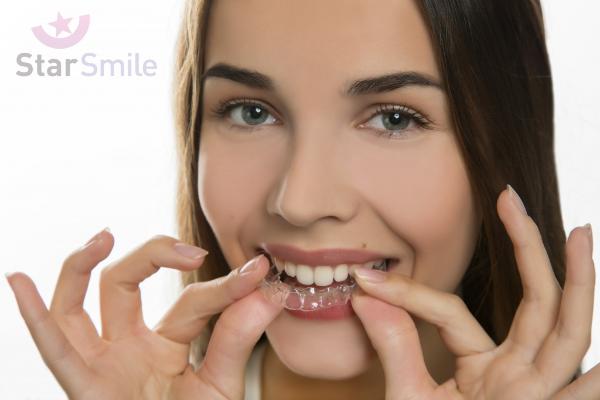 Как элайнеры выпрямляют зубы?
