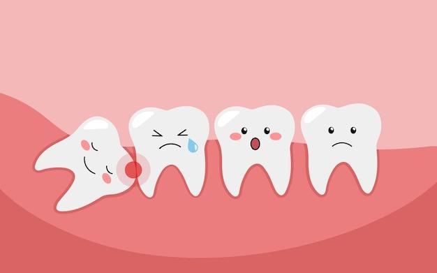 Как зубы мудрости влияют на прикус