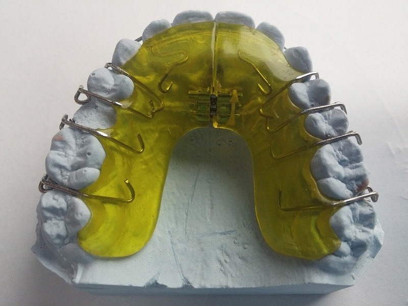 Детская ортодонтическая пластина