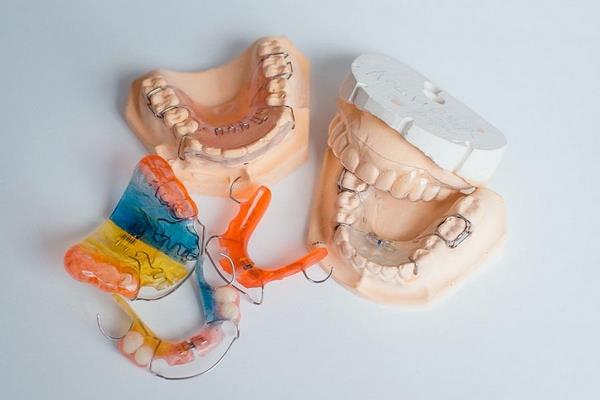 Съемные ортодонтические пластины