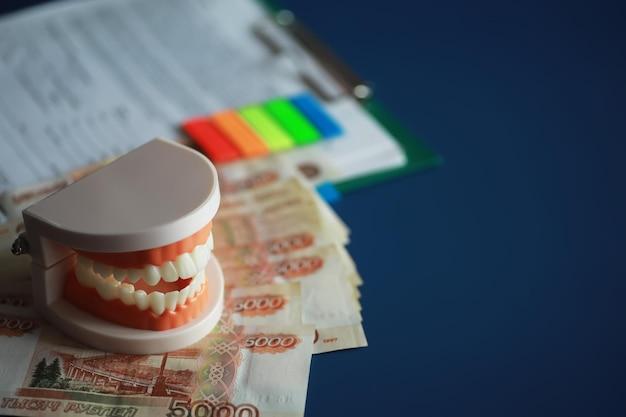 Налоговый вычет за лечение и протезирование зубов