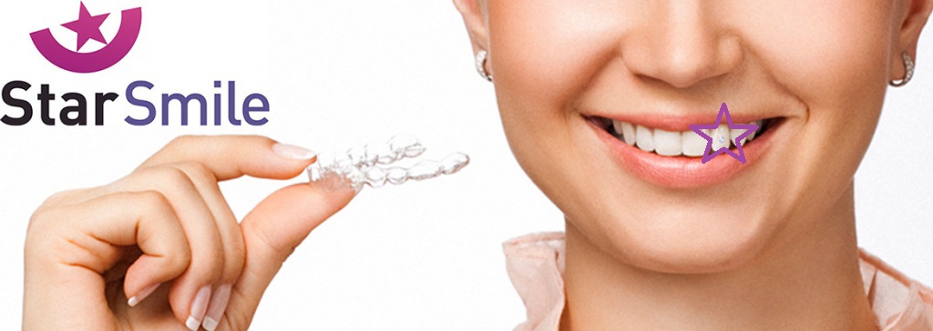 Скайсы не нужно снимать с зубов при лечении на элайнерах