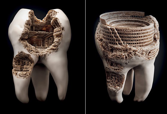 Возможные болезни и повреждения зубов