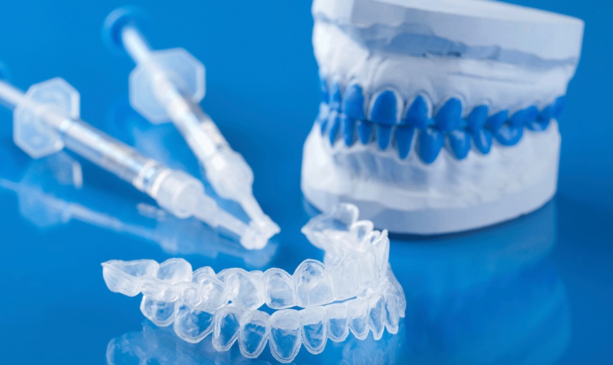 Капы для отбеливания зубов - тут нужна начальная консультация у стоматолога