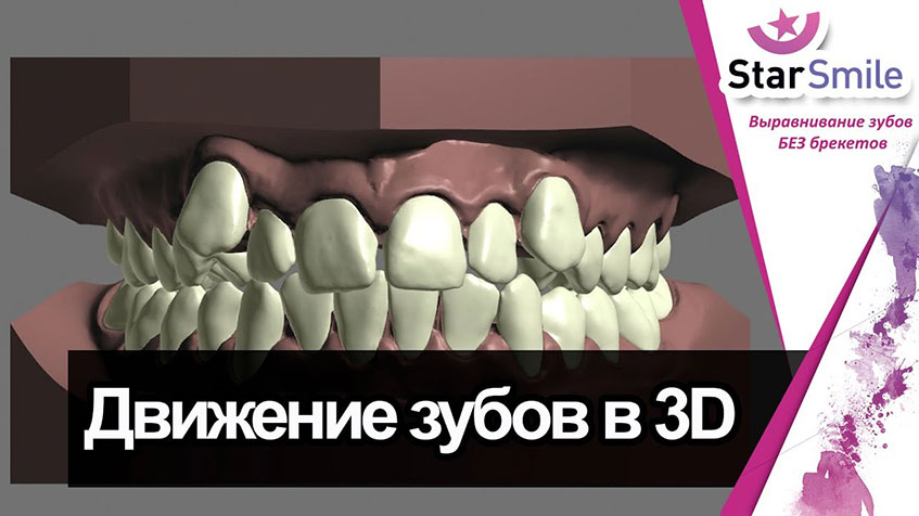 Движение зубов