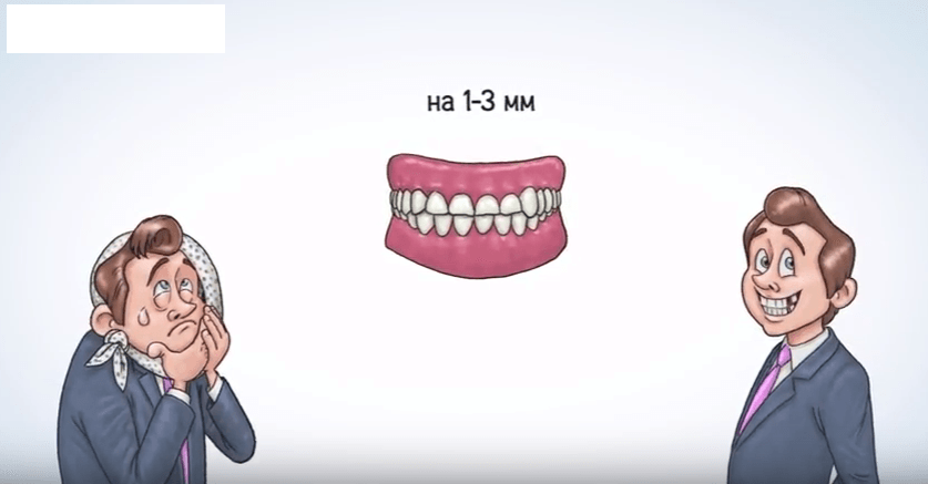 В 25 прорезаются первые зубы мудрости, которые ухудшают прикус